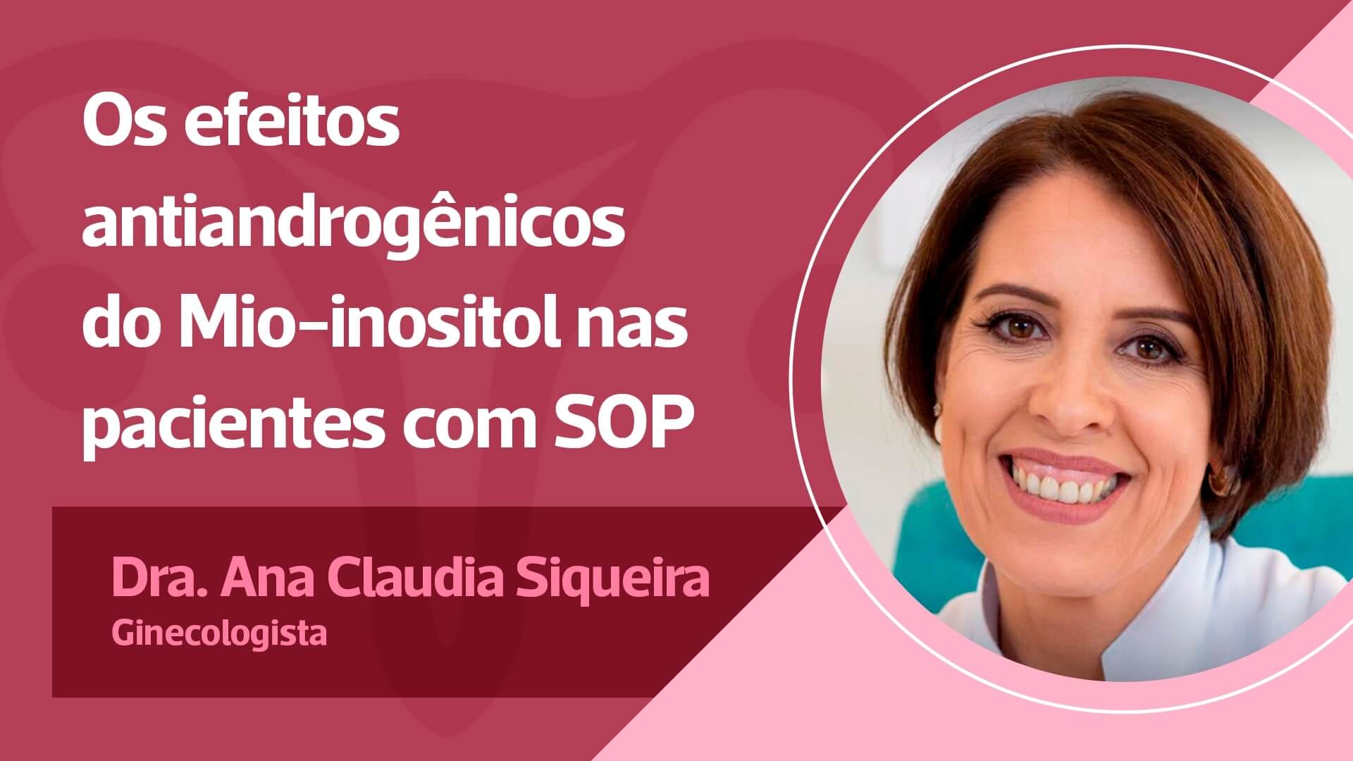 Os efeitos antiandrogênicos do Mio-inositol nas pacientes com SOP.